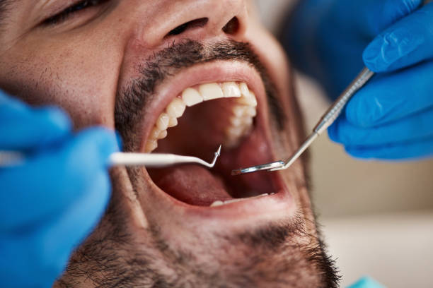Best Emergency Dental Care for Trauma or Injury in Mpo, CA